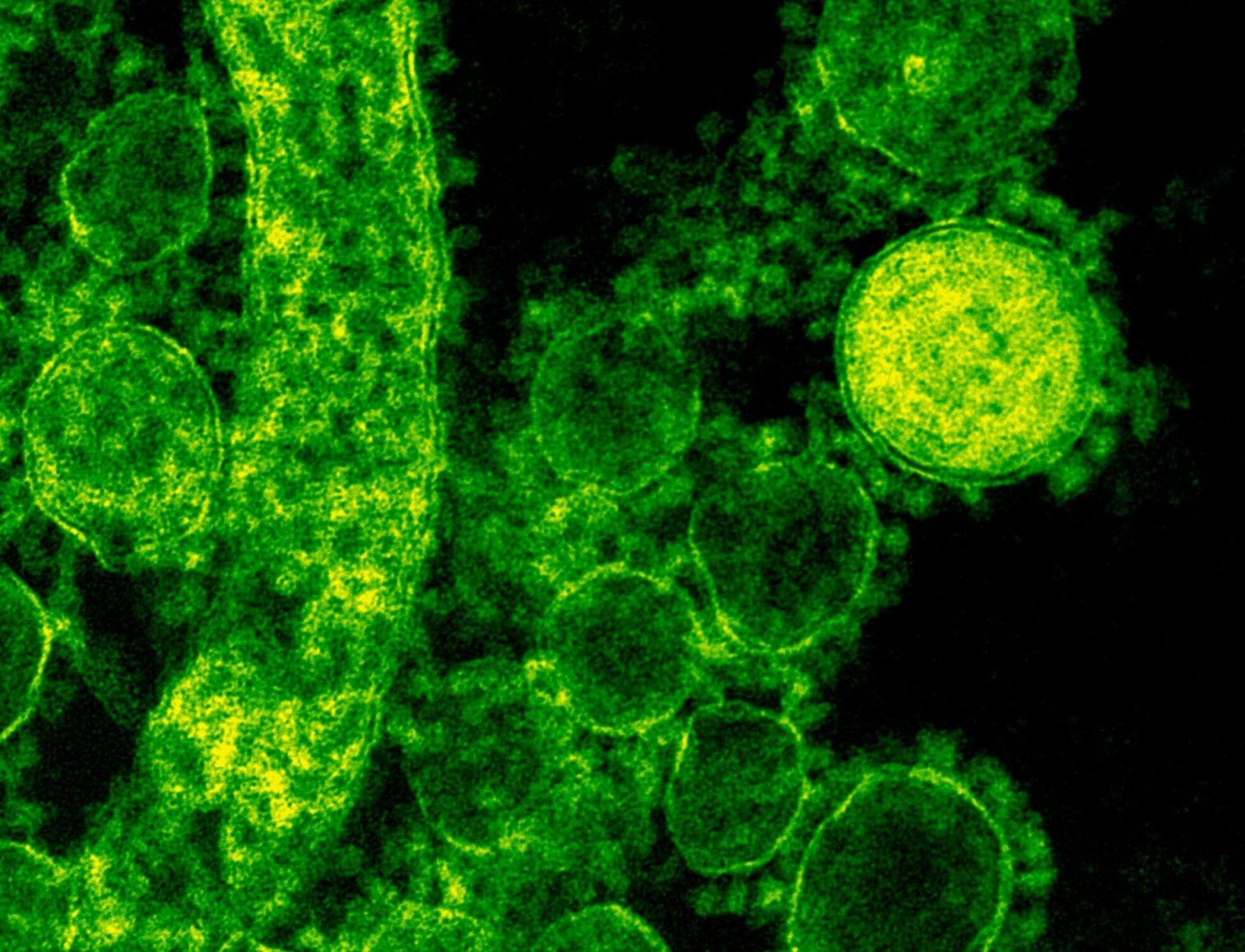 Green-tinted microscopic image of coronavirus particles illustrating viral structures.